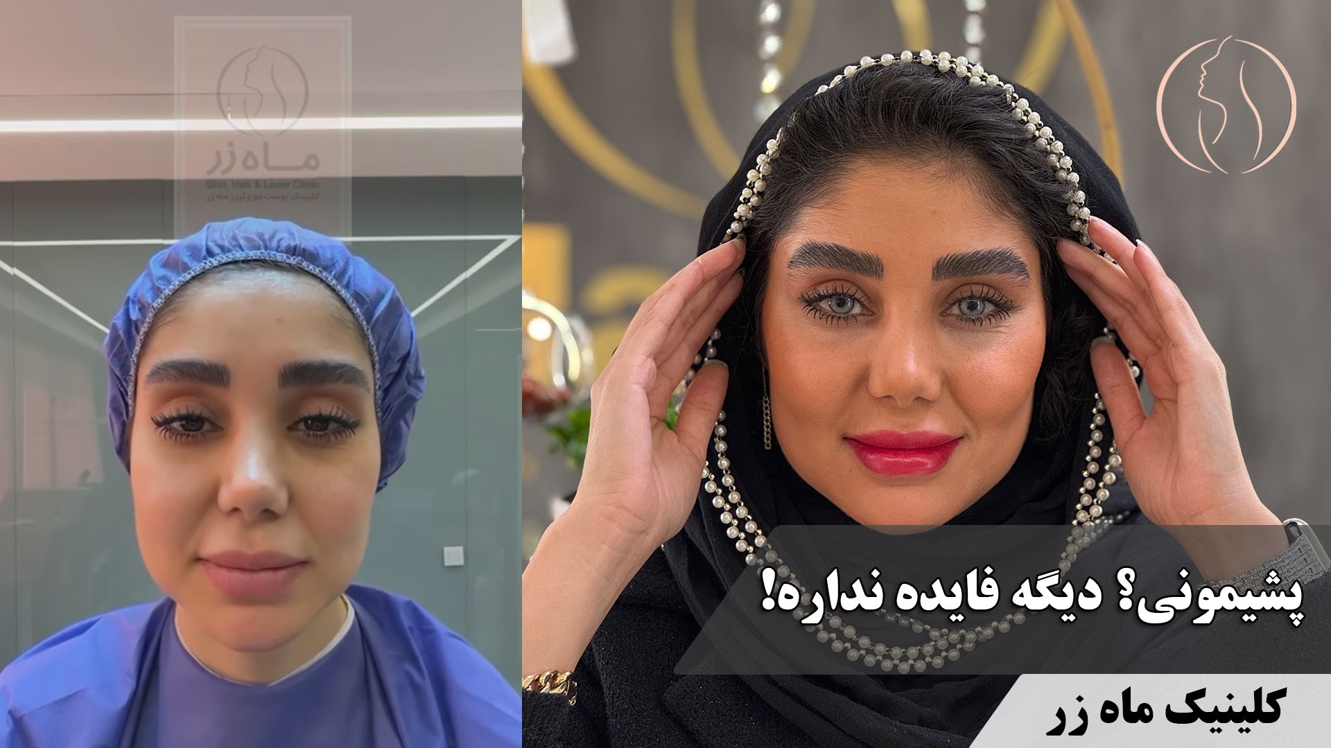 ✨ بهترین انتقام، درخشیدن توئه! ✨ ( کلینیک زیبایی ماه زر )