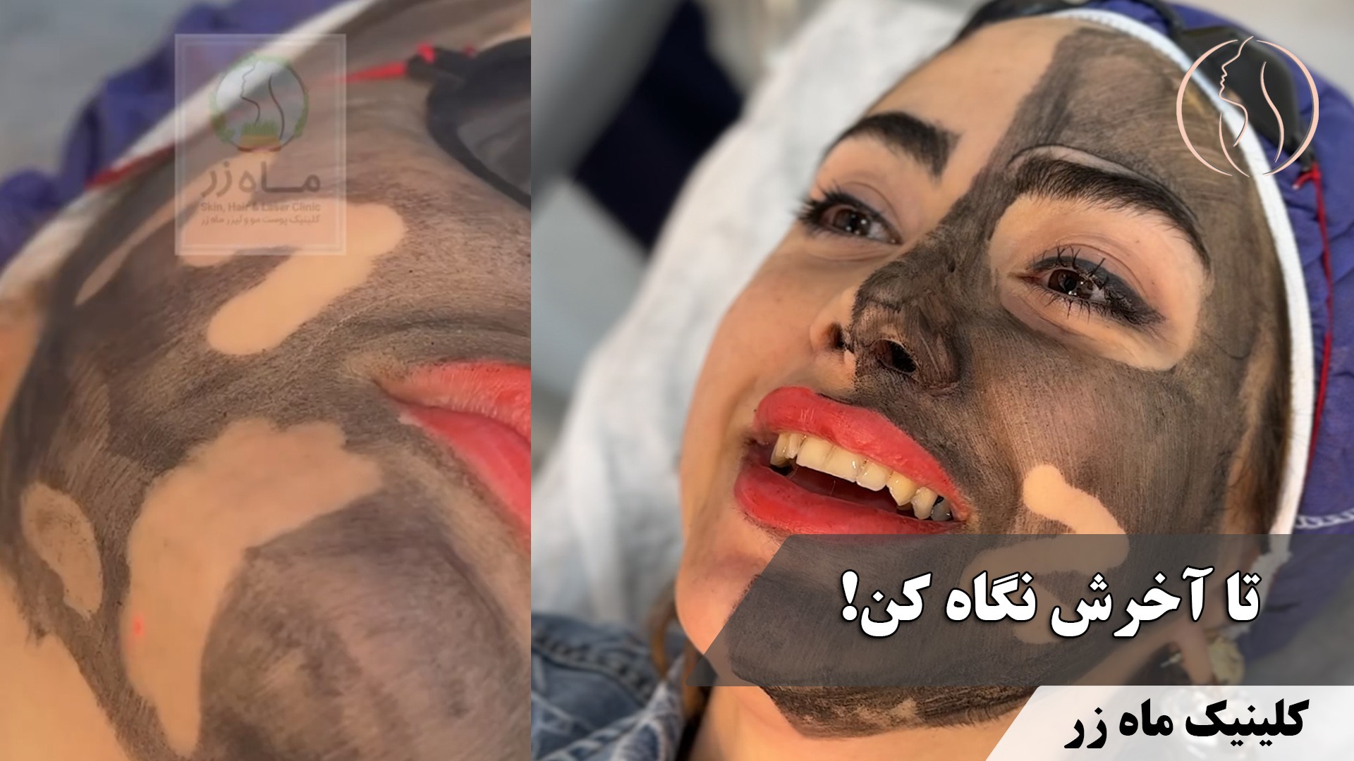 هر ماه کلی پول فیشیال میدم! ( کلینیک زیبایی ماه زر )