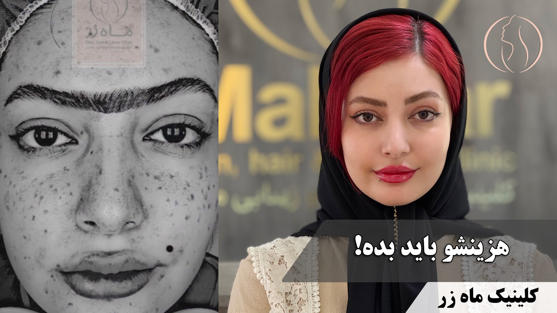 یه دختر، یه آینه، یه عالمه جای جوش… و یه شوهر بالقوه! ( ماه زر )