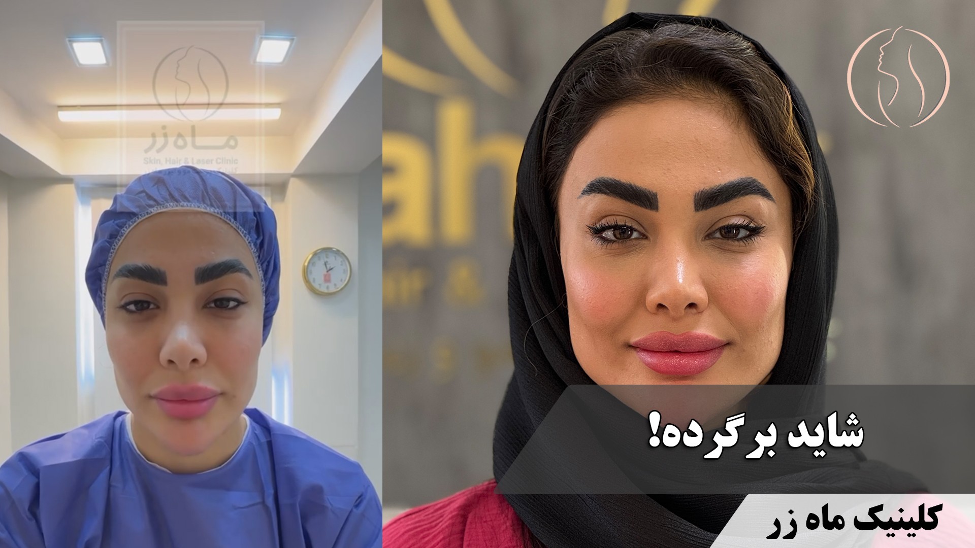 وقتی رفت… من تازه خودمو پیدا کردم! ( کلینیک زیبایی ماه زر )