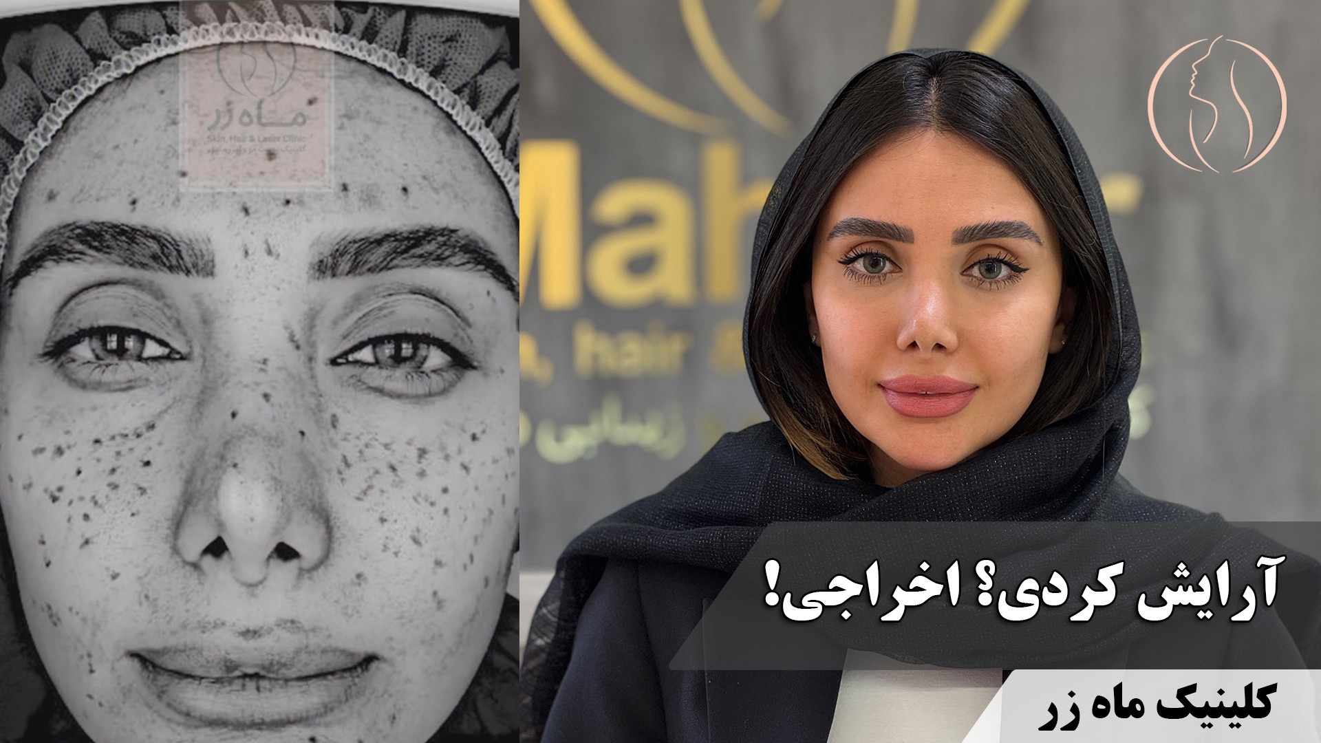 آرایش کردی؟ اخراجی! اما یه جلسه کافی بود… ( کلینیک ماه زر )