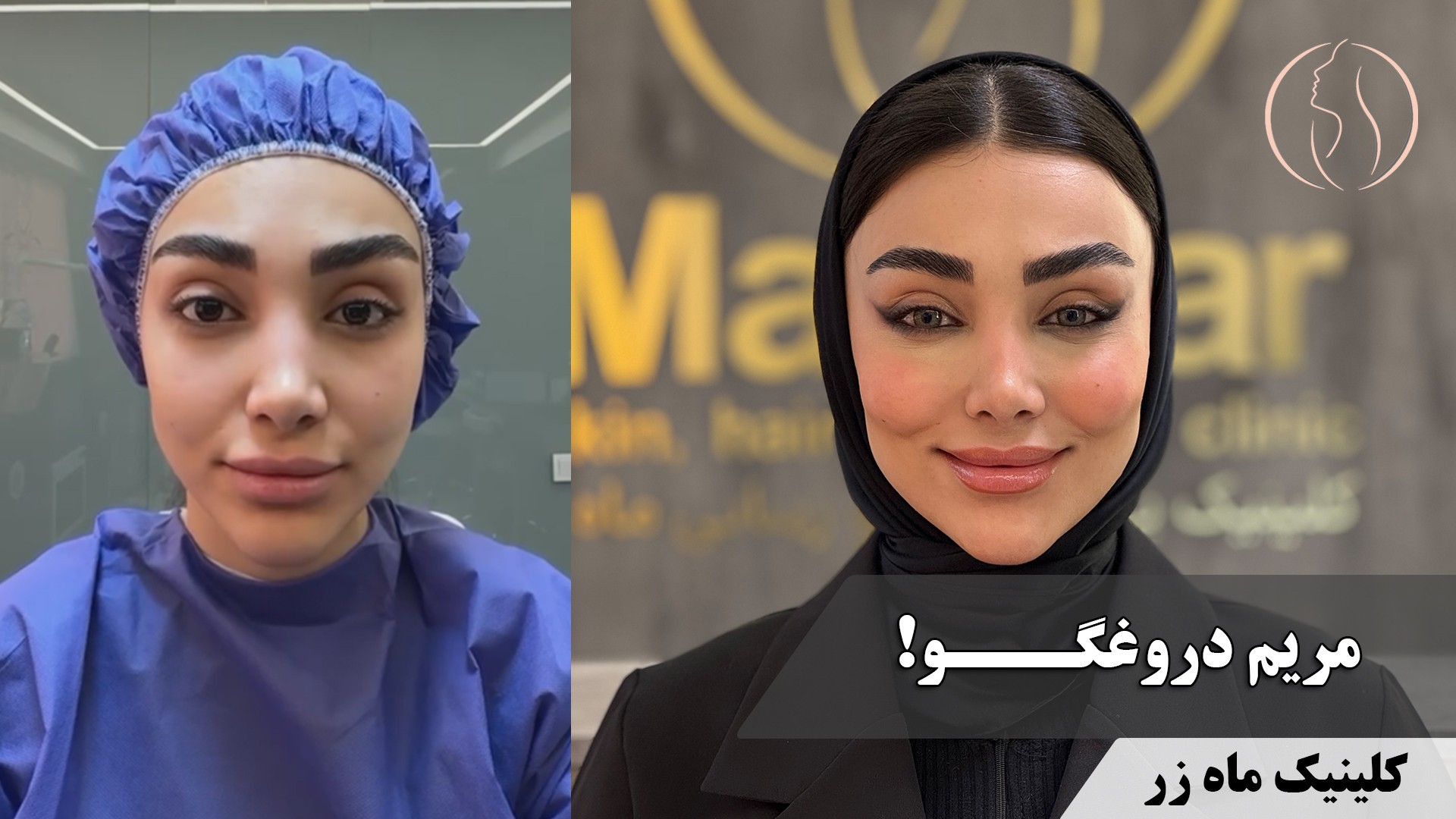 وقتی خودتو جای مریم بذاری… ( کلینیک زیبایی ماه زر )
