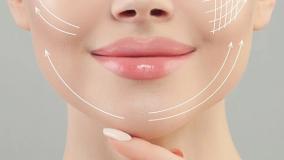 سوپر لیفت صورت