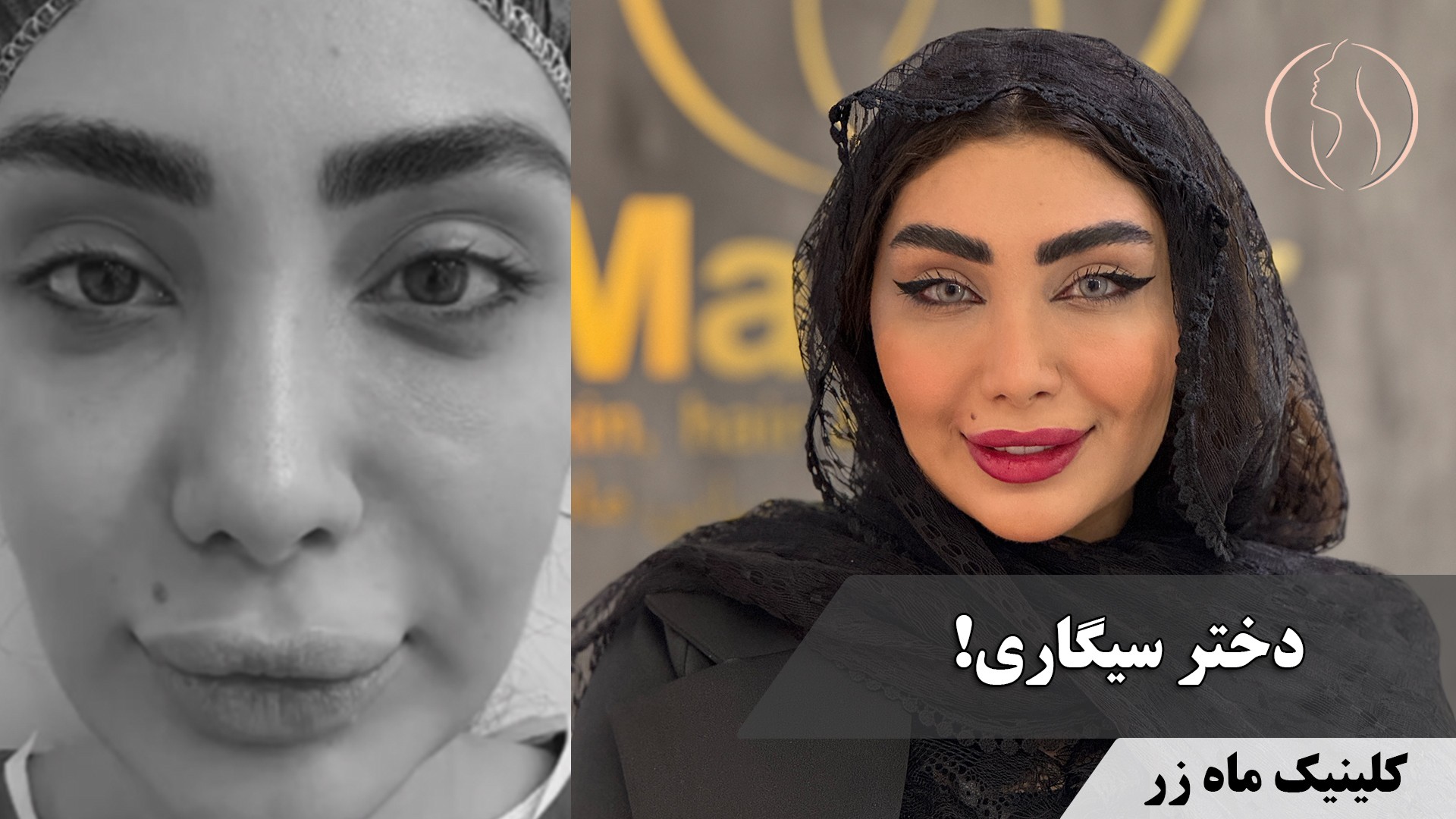 وقتی ورزش فقط یه بهونه‌ست… ( کلینیک زیبایی ماه زر )