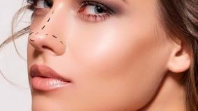 عمل زیبایی جراحی بینی :