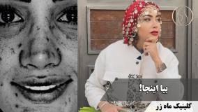تغییر، فقط یه کلمه نیست… یه حس جدیده! ✨ ( کلینیک زیبایی ماه زر )