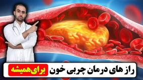 راز های درمان چربی خون برای همیشه