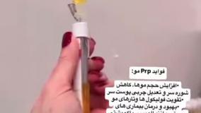 درمان ریزش مو با کیت پی آر پی