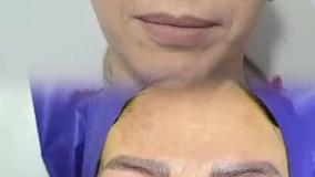 تخفیف روز دختر کلینیک زیبایی ریحانه سلامت پارسیان (پارسیان بیوتی)