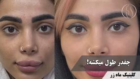 برای اون دختری که... ( کلینیک زیبایی ماه زر )
