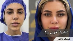 جای جوش‌ها قراره تا کی جلوتو بگیرن؟ ( کلینیک ماه زر )