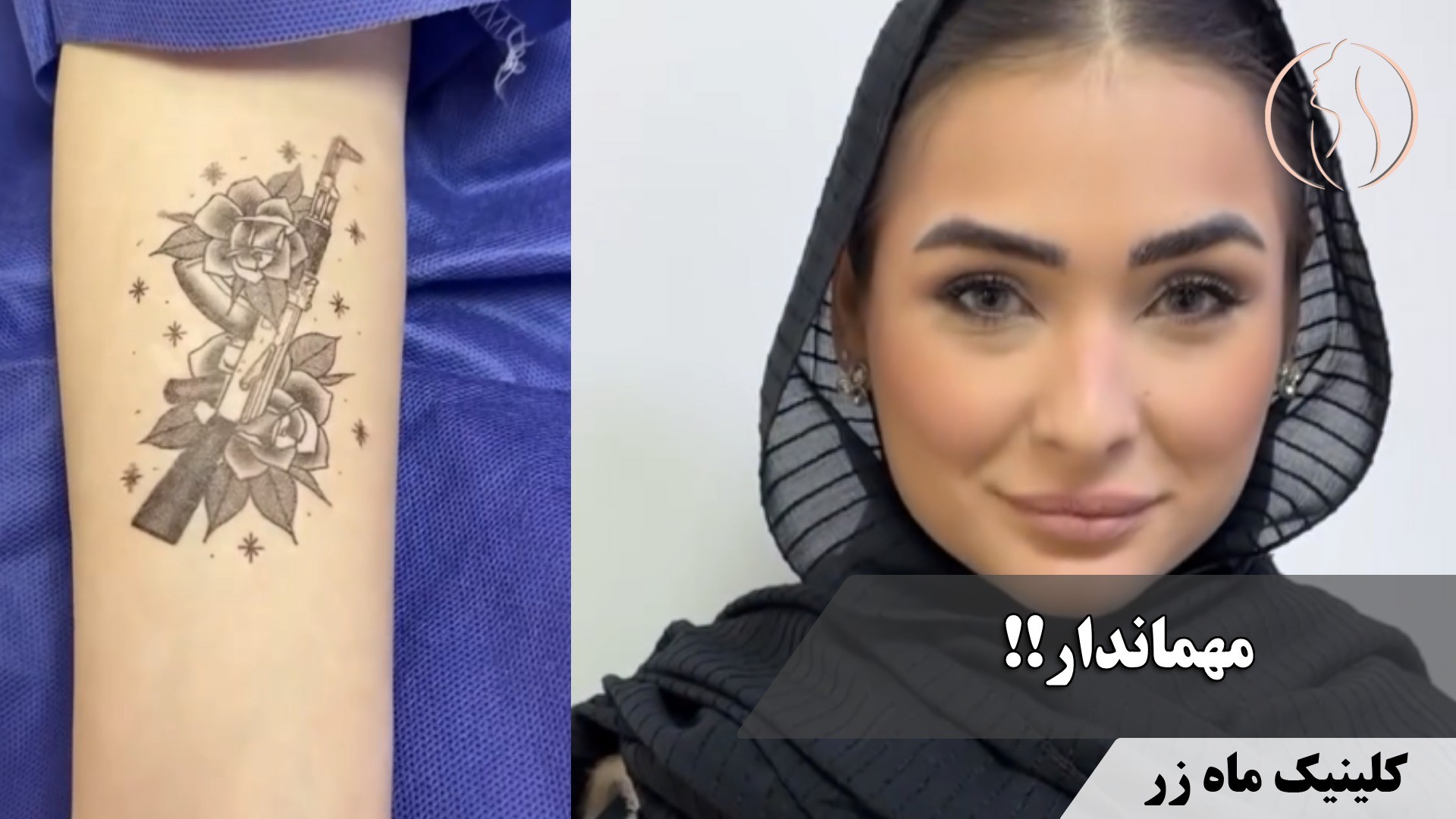 وقتی رؤیاهات با تتوهات هماهنگ نیست! ✈️🔫 ( کلینیک ماه زر )