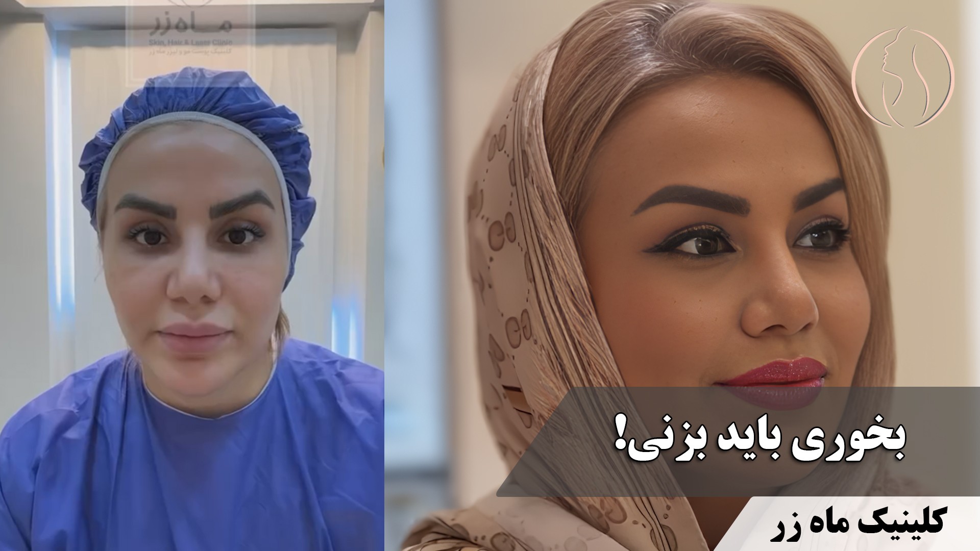 صورتت بعد رژیم لاغر شده؟ ( کلینیک زیبایی ماه زر )