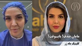 وقتی مامان‌ها می‌خوان خواهر بمونن! ( کلینیک زیبایی ماه زر )
