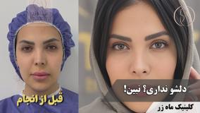 یبار برای همیشه ✨🔥 ( کلینیک زیبایی ماه زر )