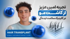 تجربه امین عزیز از کاشت مو در کلینیک سلامت ایده آل