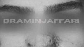 درمان نکروز ناشی از تزریق ۶ سی سی ژل