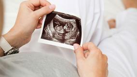 مزایا سونوگرافی سه بعدی نسبت به سونوگرافی دو بعدی :