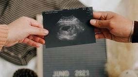 انجام سونوگرافی آنومالی در بارداری :