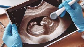 سونوگرافی بیوفیزیکال :