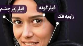 تغییر چهره پریناز ایزدیار