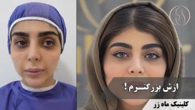 عشق، چربی، قضاوت 💉❤️‍🔥👀 ( کلینیک زیبایی ماه زر )