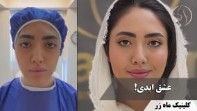 چشم دلتو فقط واسه من نگه دار! ✨👀❤️ ( کلینیک زیبایی ماه زر )