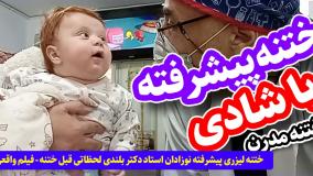 ختنه لیزری پیشرفته نوزادان استاد دکتر بلندی لحظاتی قبل ختنه - فیلم واقعی