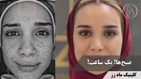 یه ساعت آرایش هر صبح ⏳ ( کلینیک زیبایی ماه زر )