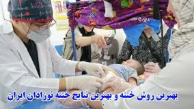 بهترین روش ختنه و بهترین نتایج ختنه نوزادان ایران