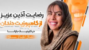 رضایت آذین عزیز از کامپوزیت دندان در بارانا