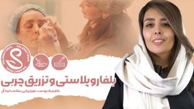 جراحی پلک مشهد همراه با تزریق چربی در سلامت ایده آل
