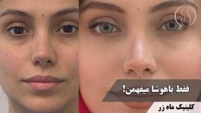 وقتی دلت یه نفس راحت بدون آرایش می‌خواد 😮‍💨🌸 ( کلینیک ماه زر )