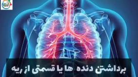 یک راه عالی برای معافیت سربازی / مشاوره نظام وظیفه آویژه