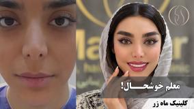 معلمی که یاد گرفت به خودش هم اهمیت بده ✨ ( کلینیک ماه زر )