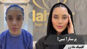 وقتی پرستار از خودش غافل می‌مونه ( کلینیک زیبایی ماه زر )