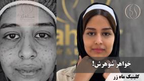وقتشه منم حال خودمو داشته باشم! ( کلینیک زیبایی ماه زر )