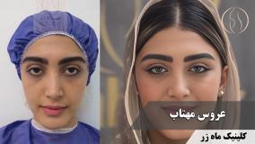 شاید دیر باشه… ولی من هنوزم می‌خوام تغییر کنم ( کلینیک زیبایی ماه زر )