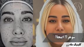 کاش یه جلسه کافی باشه ( کلینیک زیبایی ماه زر )