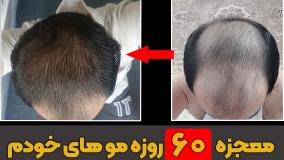 معجزه 60 روزه موهای خودم