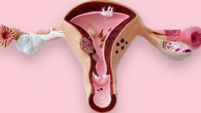 عمل واژینوپلاستی