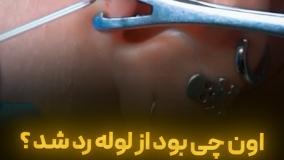 اون چی بود از لوله رد شد؟