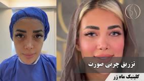 وقتی مامان می‌خواد دوباره دختر بشه… ( کلینیک زیبایی ماه زر )