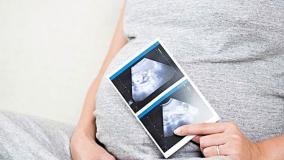 در طول بارداری چند نوبت سونوگرافی باید انجام شود ؟