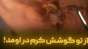 از تو گوشش کرم دراومد !
