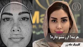 این‌بار برای دل خودم ... ( کلینیک زیبایی ماه زر )
