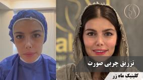 ✨ برگرد به اون صورتِ پر و قشنگت! 💁‍♀️💫 ( کلینیک زیبایی ماه زر )