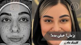 منم مثل تو بودم... ( کلینیک زیبایی ماه زر )
