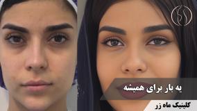 گاهی آینه چیزهایی نشون می‌ده که فقط خودمون می‌بینیم... ( کلینیک زیبایی ماه زر )