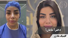 دخترم گفت: مامان چرا اینقدر پیر شدی؟ ( کلینیک زیبایی ماه زر )